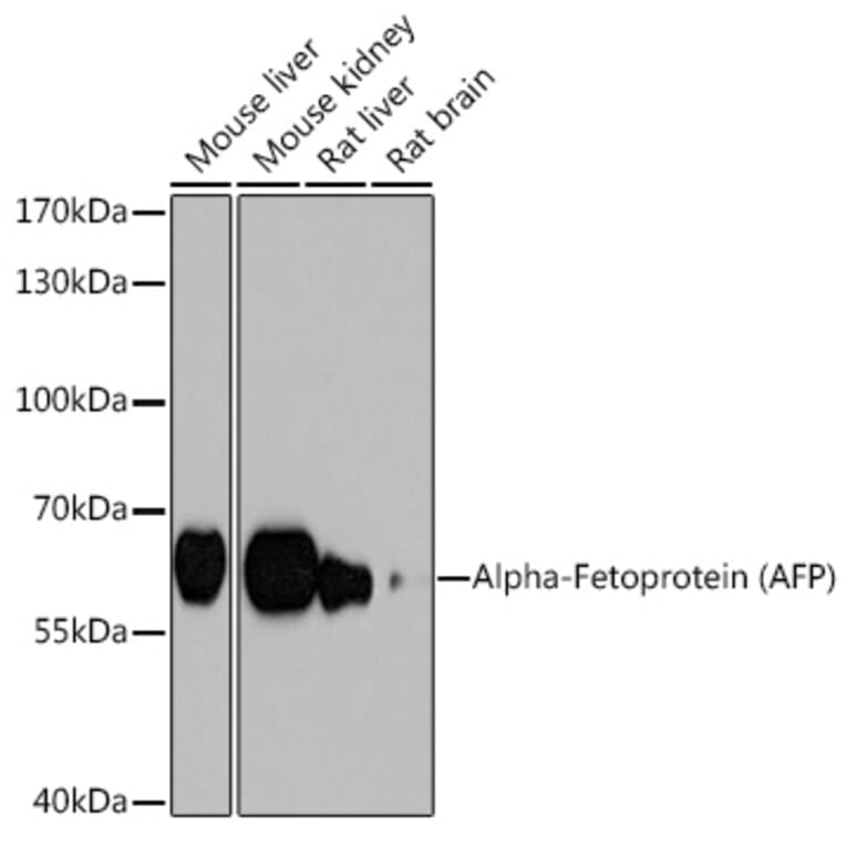 Western Blot - Anti-alpha 1 Fetoprotein Antibody (A12534) - Antibodies.com