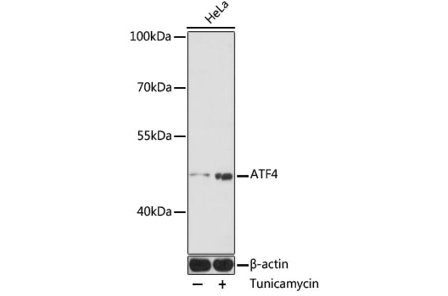 Western Blot - Anti-ATF-4 Antibody (A12535) - Antibodies.com