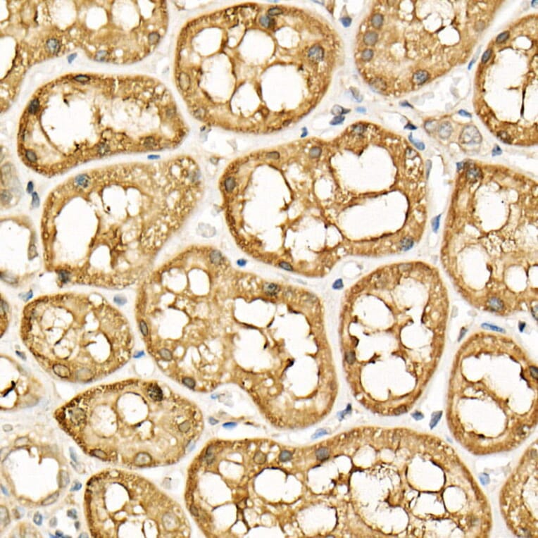 Immunohistochemistry - Anti-ATF6 Antibody (A12536) - Antibodies.com