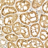 Immunohistochemistry - Anti-ATF6 Antibody (A12536) - Antibodies.com