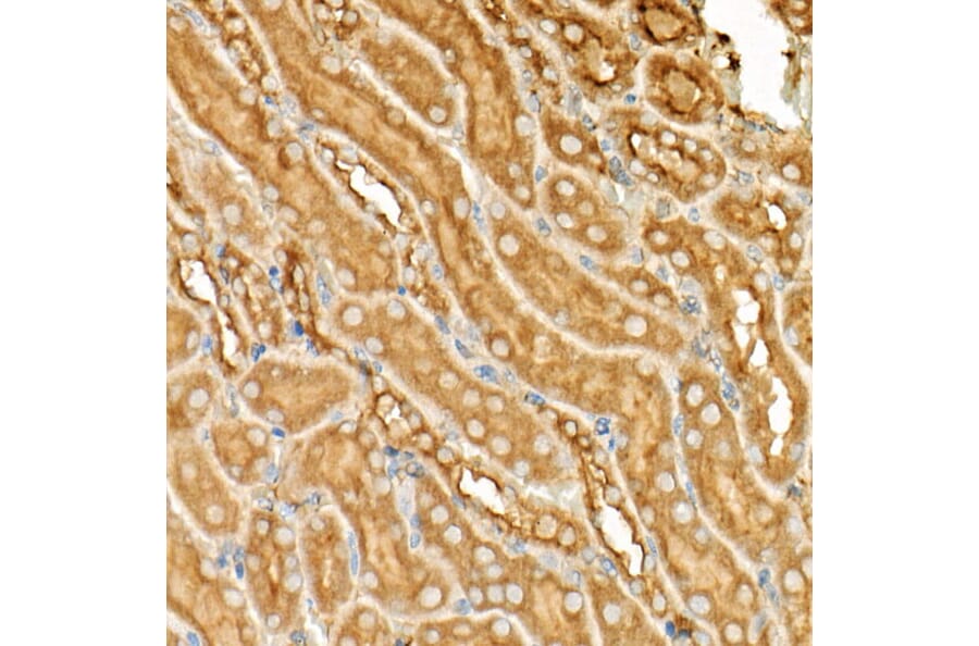 Immunohistochemistry - Anti-ATF6 Antibody (A12536) - Antibodies.com