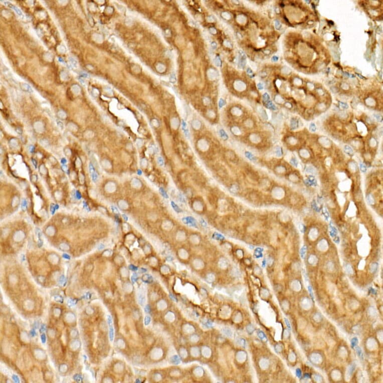 Immunohistochemistry - Anti-ATF6 Antibody (A12536) - Antibodies.com