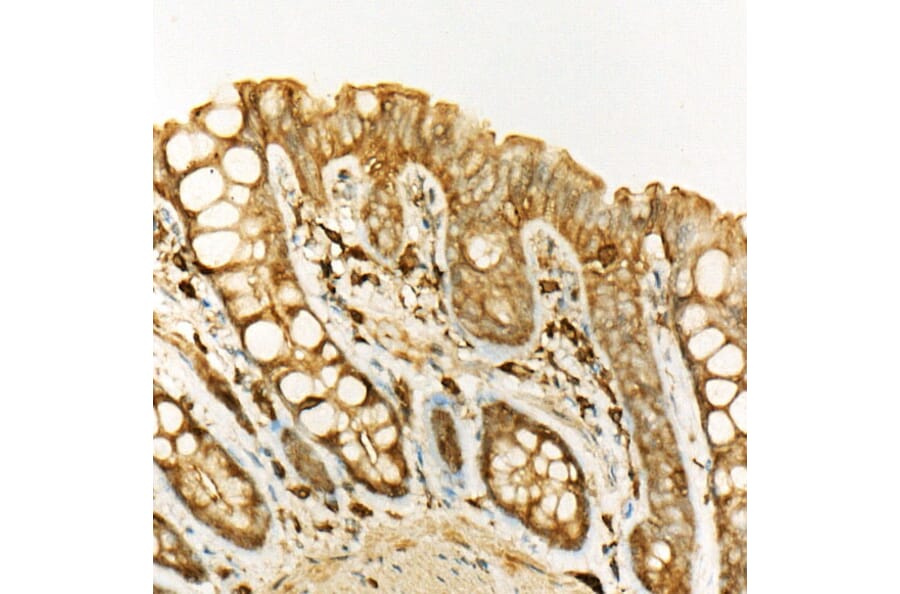 Immunohistochemistry - Anti-ATF6 Antibody (A12536) - Antibodies.com