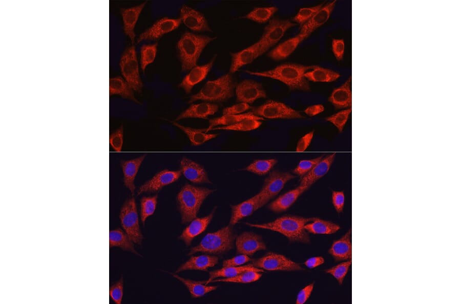 Immunofluorescence - Anti-ATF6 Antibody (A12536) - Antibodies.com