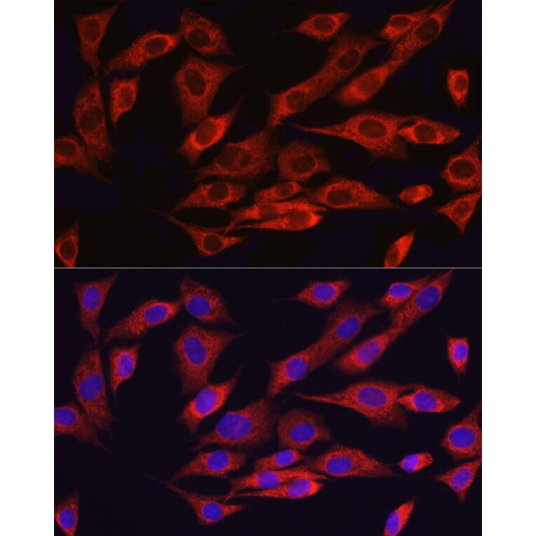 Immunofluorescence - Anti-ATF6 Antibody (A12536) - Antibodies.com