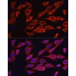 Immunofluorescence - Anti-ATF6 Antibody (A12536) - Antibodies.com