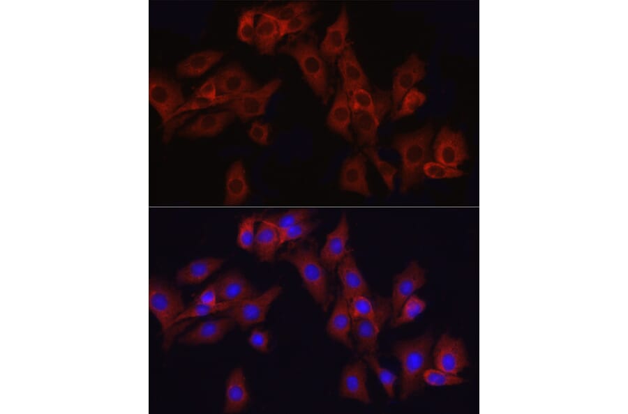 Immunofluorescence - Anti-ATF6 Antibody (A12536) - Antibodies.com