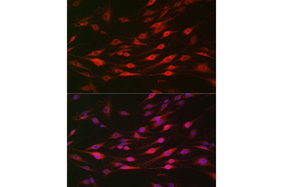 Immunofluorescence - Anti-Bak Antibody (A12537) - Antibodies.com