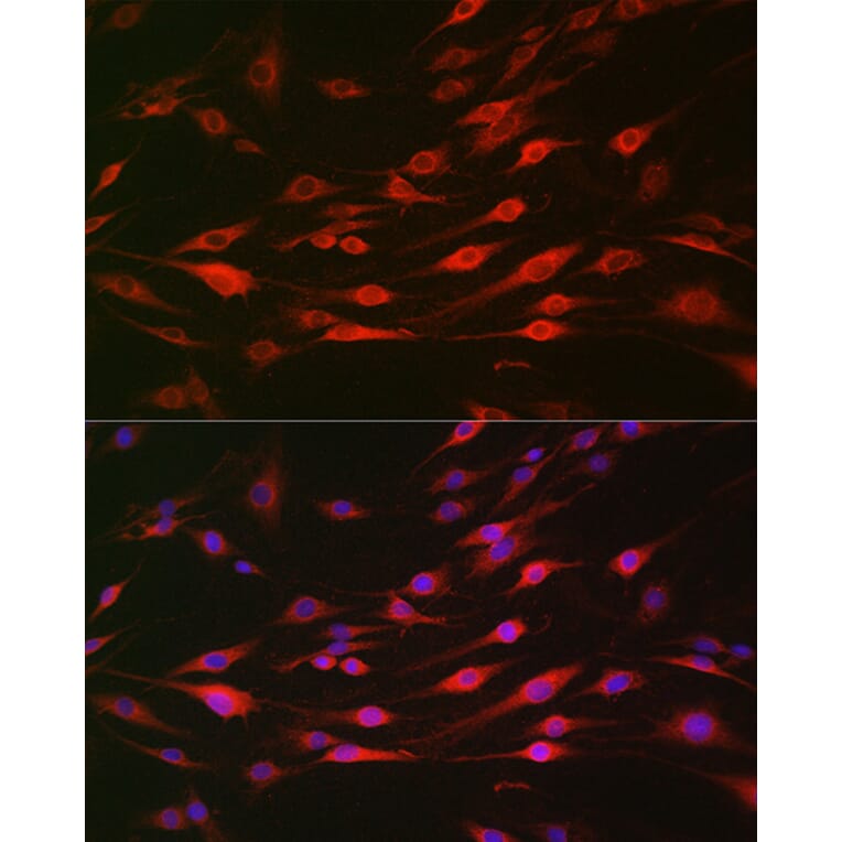 Immunofluorescence - Anti-Bak Antibody (A12537) - Antibodies.com