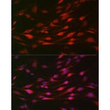 Immunofluorescence - Anti-Bak Antibody (A12537) - Antibodies.com