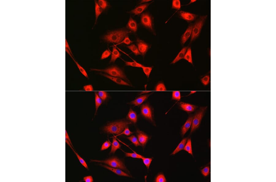 Immunofluorescence - Anti-Bak Antibody (A12537) - Antibodies.com