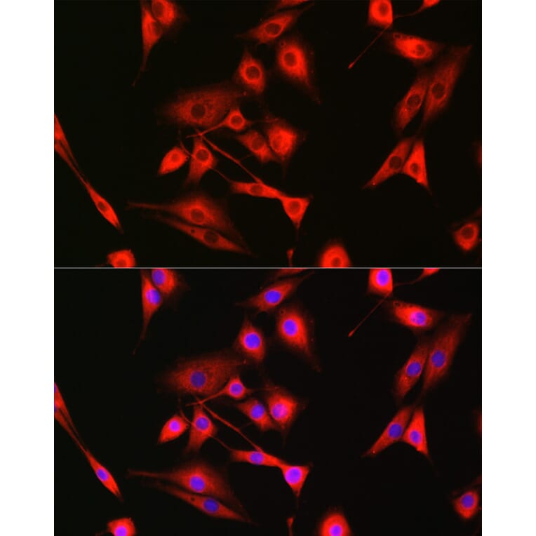 Immunofluorescence - Anti-Bak Antibody (A12537) - Antibodies.com