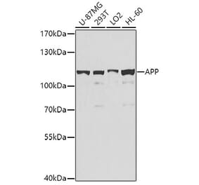 Western Blot - Anti-Amyloid Precursor Protein Antibody (A12538) - Antibodies.com