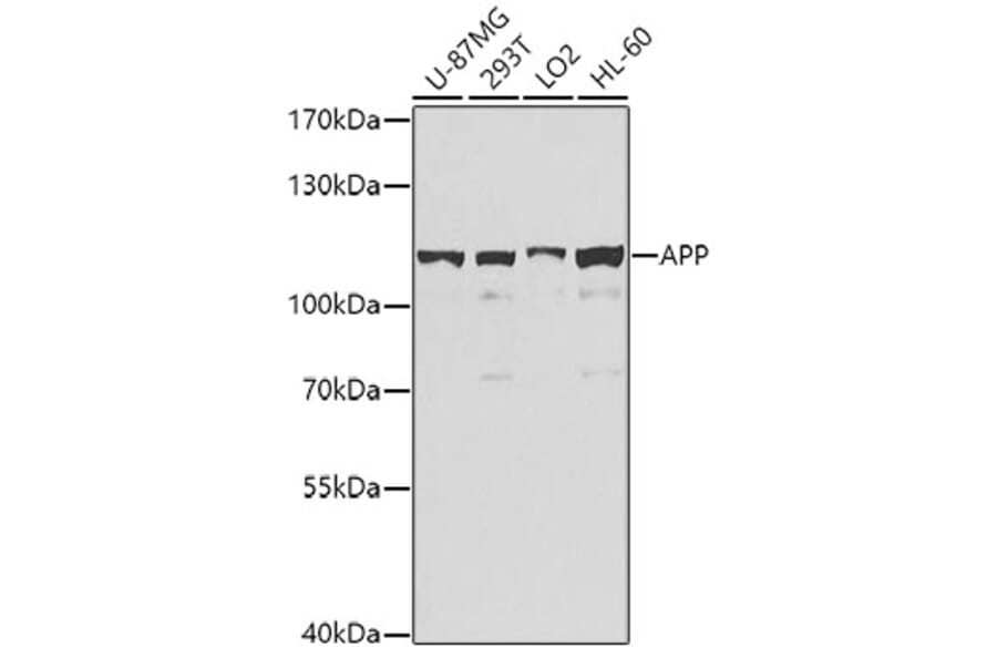 Anti Amyloid Precursor Protein Antibody A12538