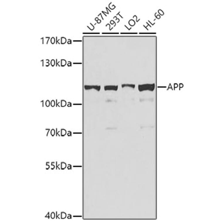 Western Blot - Anti-Amyloid Precursor Protein Antibody (A12538) - Antibodies.com