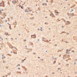 Immunohistochemistry - Anti-Bax Antibody (A12539) - Antibodies.com