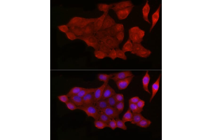 Immunofluorescence - Anti-Bax Antibody (A12539) - Antibodies.com