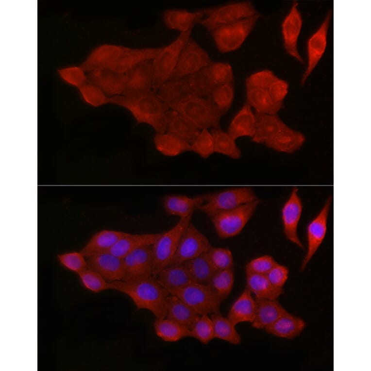 Immunofluorescence - Anti-Bax Antibody (A12539) - Antibodies.com