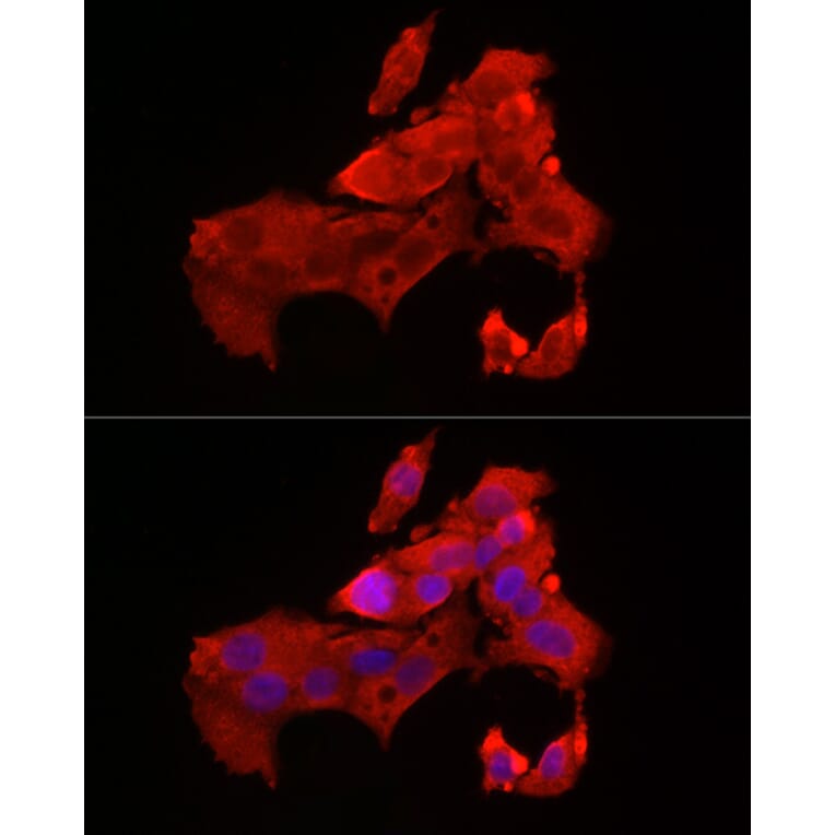 Immunofluorescence - Anti-Bax Antibody (A12539) - Antibodies.com