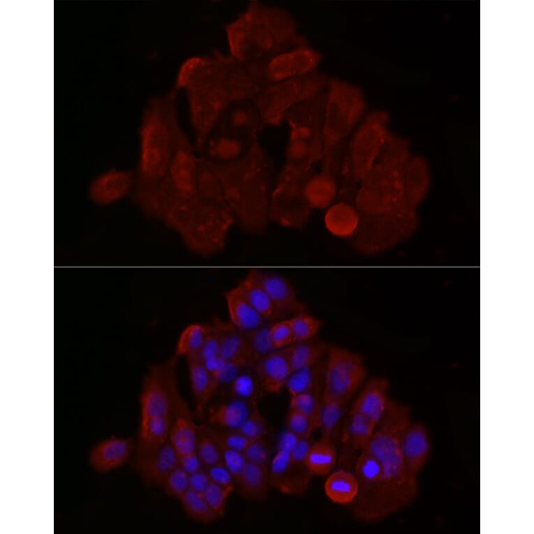 Immunofluorescence - Anti-Bax Antibody (A12539) - Antibodies.com