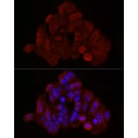 Immunofluorescence - Anti-Bax Antibody (A12539) - Antibodies.com