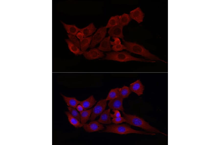 Immunofluorescence - Anti-Bax Antibody (A12539) - Antibodies.com