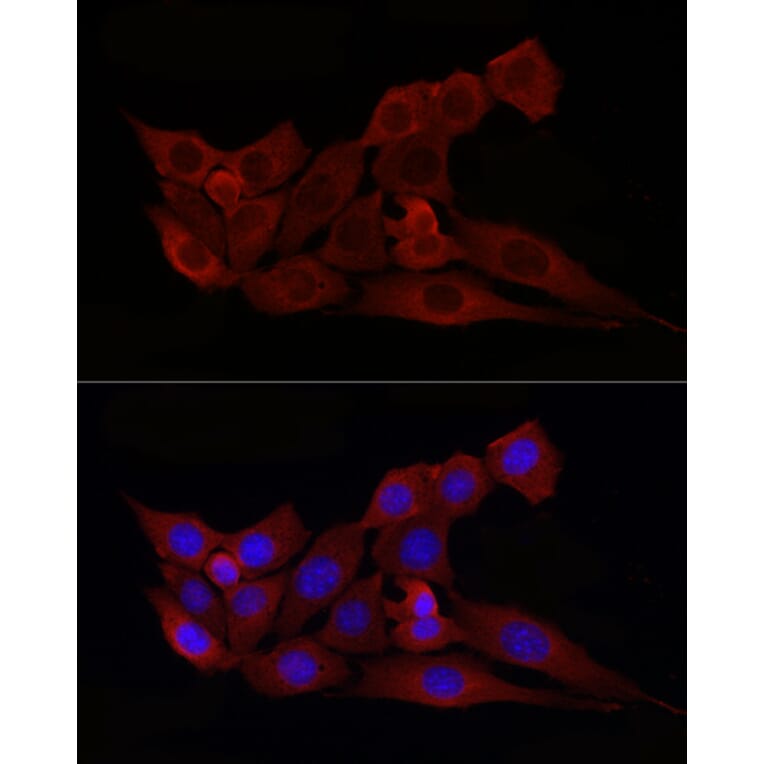 Immunofluorescence - Anti-Bax Antibody (A12539) - Antibodies.com