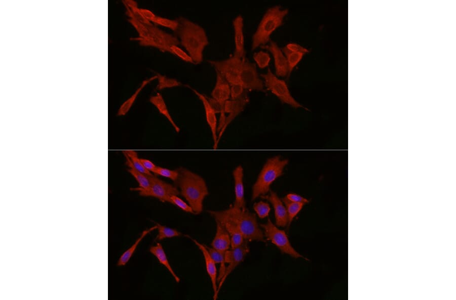 Immunofluorescence - Anti-Bax Antibody (A12539) - Antibodies.com