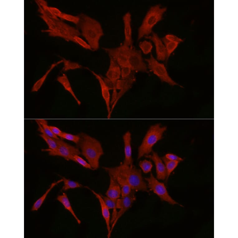 Immunofluorescence - Anti-Bax Antibody (A12539) - Antibodies.com