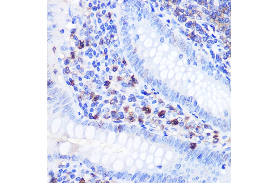 Immunohistochemistry - Anti-Bcl-2 Antibody (A12540) - Antibodies.com