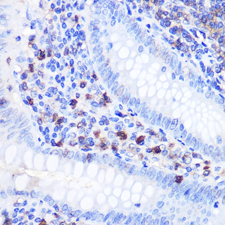 Immunohistochemistry - Anti-Bcl-2 Antibody (A12540) - Antibodies.com