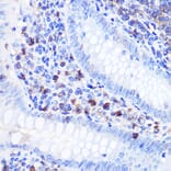 Immunohistochemistry - Anti-Bcl-2 Antibody (A12540) - Antibodies.com