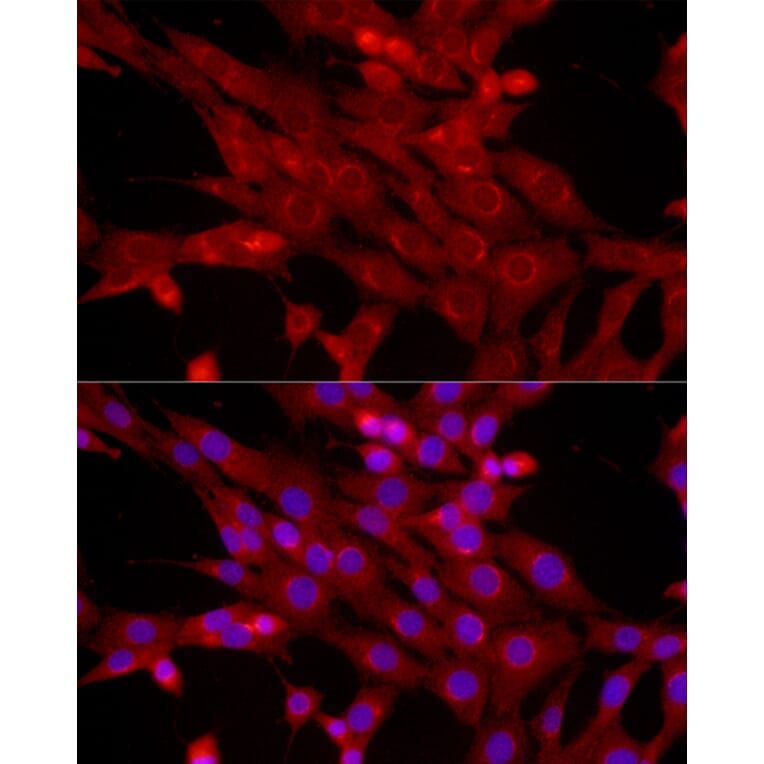 Immunofluorescence - Anti-Bcl-2 Antibody (A12540) - Antibodies.com