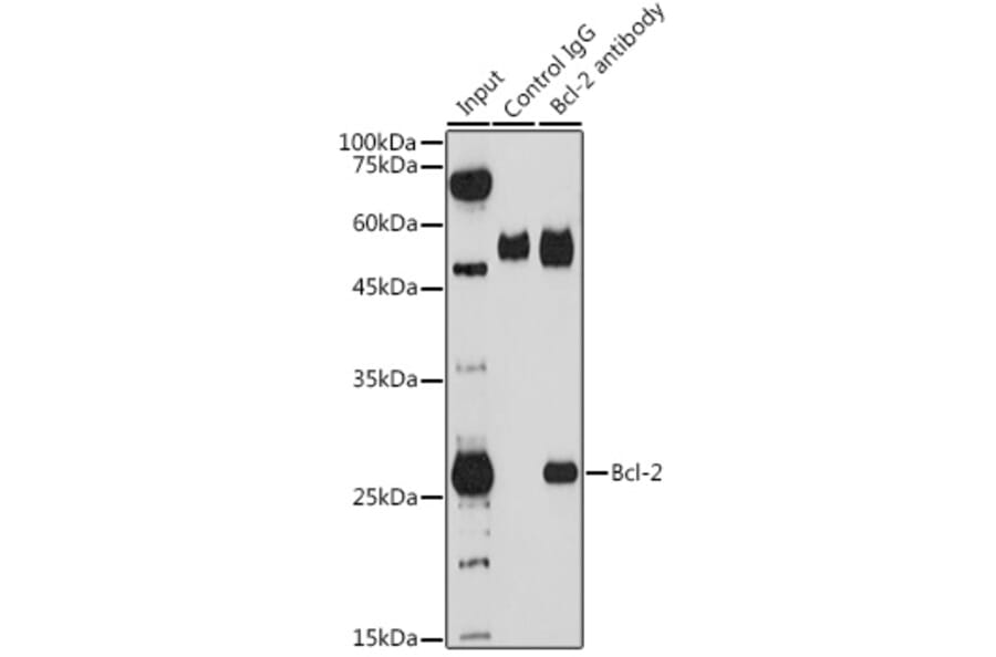 Western Blot - Anti-Bcl-2 Antibody (A12540) - Antibodies.com
