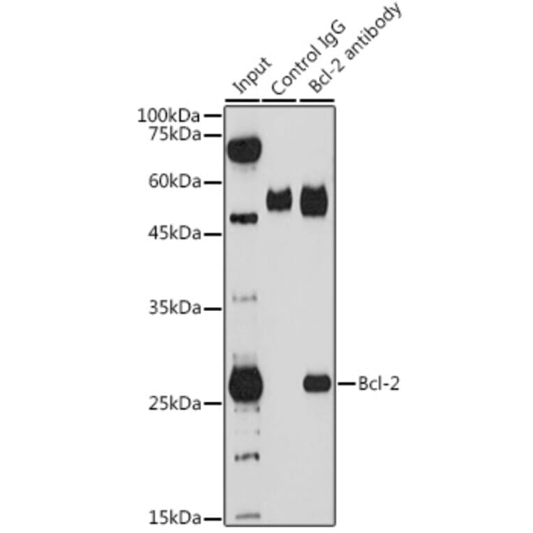 Western Blot - Anti-Bcl-2 Antibody (A12540) - Antibodies.com