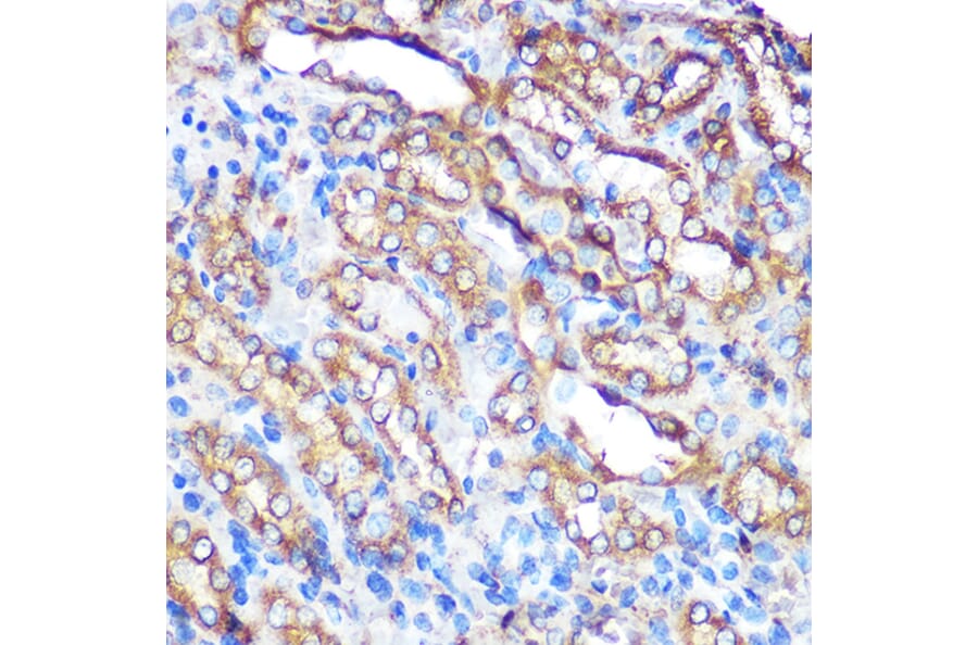Immunohistochemistry - Anti-Bcl-XL Antibody (A12541) - Antibodies.com