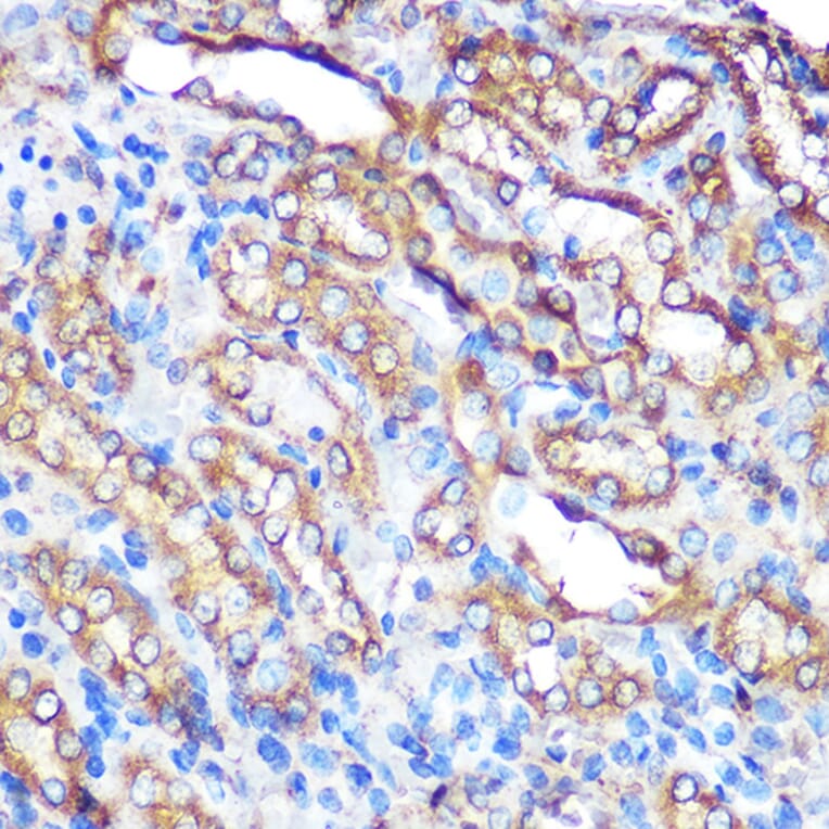 Immunohistochemistry - Anti-Bcl-XL Antibody (A12541) - Antibodies.com