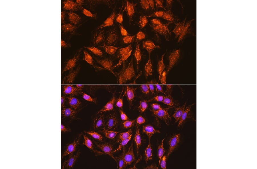 Immunofluorescence - Anti-Bcl-XL Antibody (A12541) - Antibodies.com