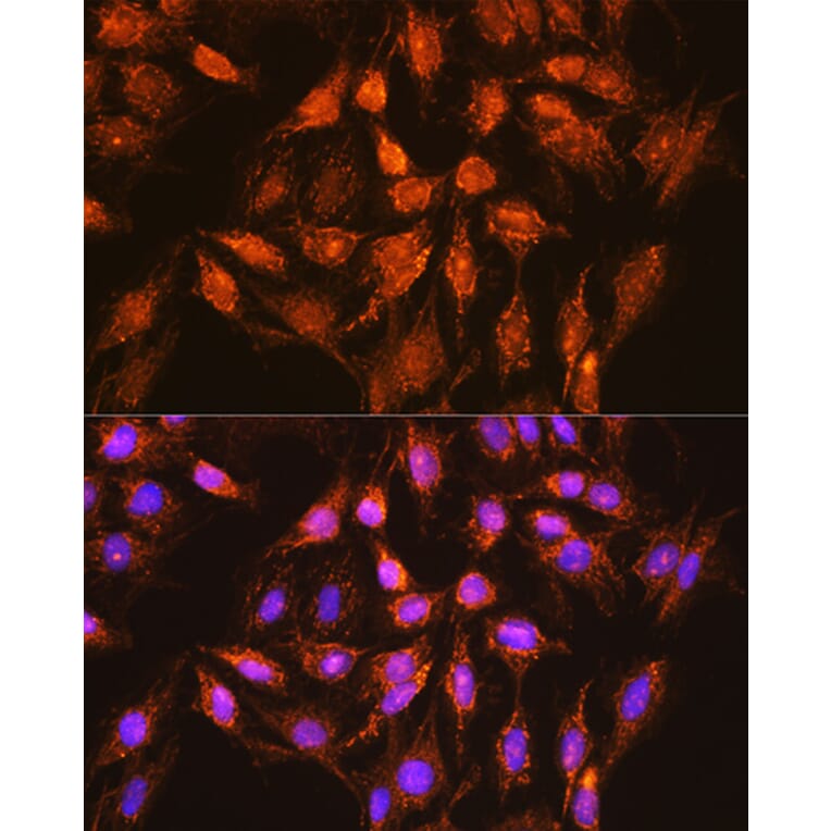 Immunofluorescence - Anti-Bcl-XL Antibody (A12541) - Antibodies.com