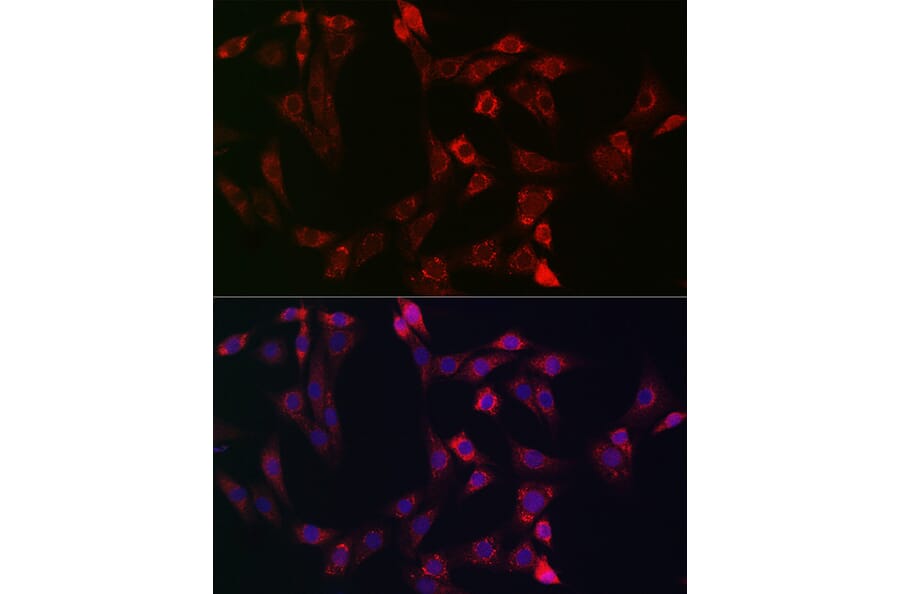 Immunofluorescence - Anti-Bid Antibody (A12542) - Antibodies.com