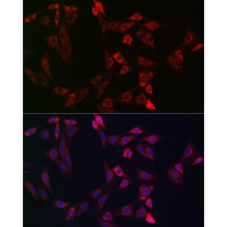 Immunofluorescence - Anti-Bid Antibody (A12542) - Antibodies.com