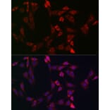 Immunofluorescence - Anti-Bid Antibody (A12542) - Antibodies.com