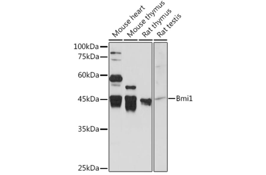 Western Blot - Anti-Bmi1 Antibody (A12543) - Antibodies.com