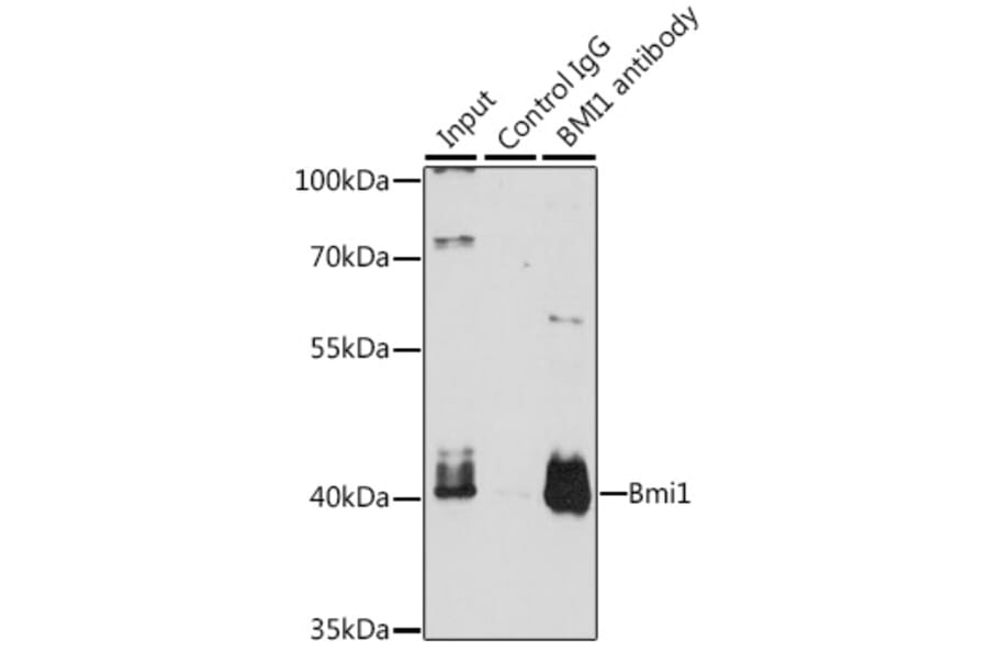 Western Blot - Anti-Bmi1 Antibody (A12543) - Antibodies.com