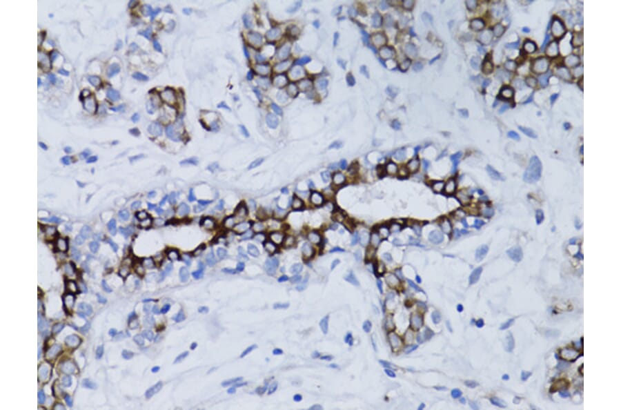 Immunohistochemistry - Anti-BRCA1 Antibody (A12544) - Antibodies.com