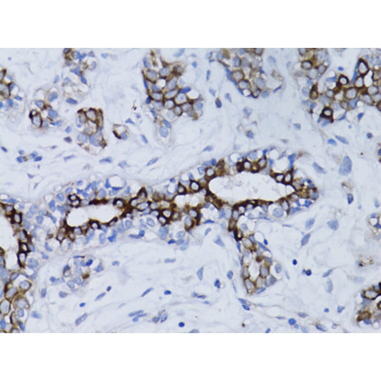 Immunohistochemistry - Anti-BRCA1 Antibody (A12544) - Antibodies.com
