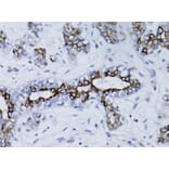 Immunohistochemistry - Anti-BRCA1 Antibody (A12544) - Antibodies.com