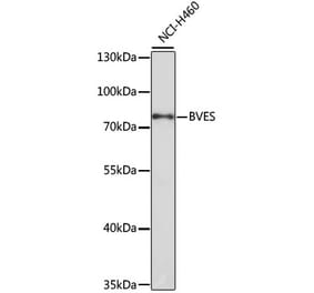Western Blot - Anti-BVES Antibody (A12545) - Antibodies.com