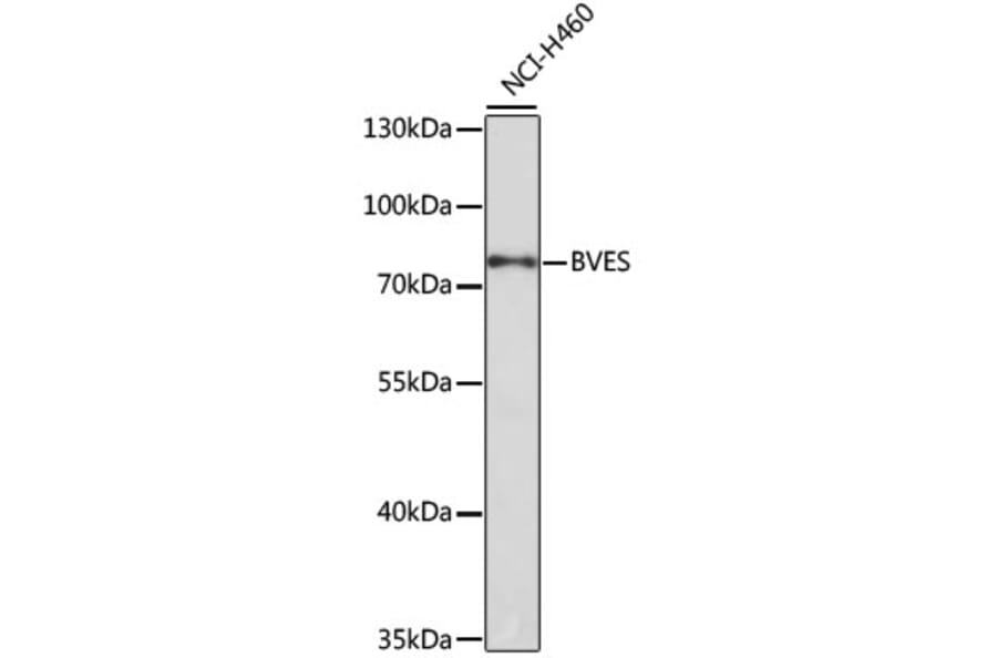 Western Blot - Anti-BVES Antibody (A12545) - Antibodies.com