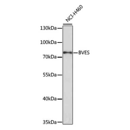 Western Blot - Anti-BVES Antibody (A12545) - Antibodies.com
